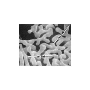 Aluminum-Tungsten Dendrites - Systems for Research